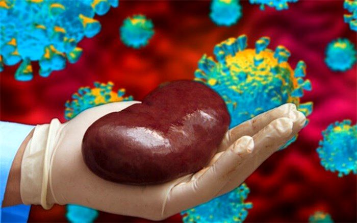 نارسایی حاد کلیه در بیماران مبتلا به کووید-۱۹