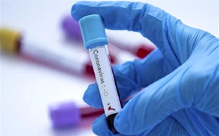 خوزستان بالاتراز  میانگین کشوری به لحاظ تعداد نمونه گیری ها