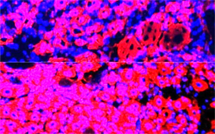 معکوس کردن روند پیری با رقیق کردن پلاسمای خون
