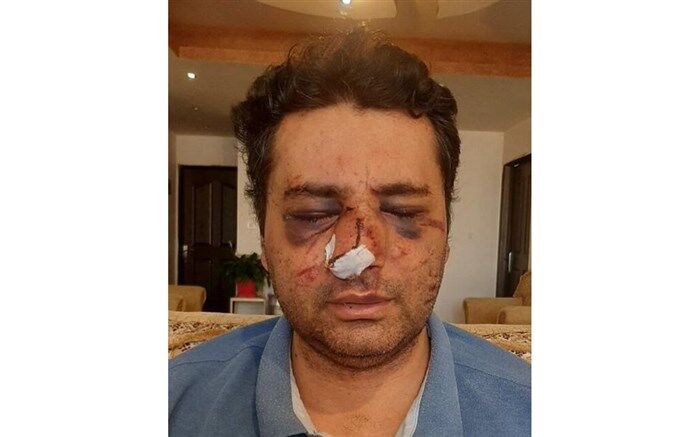 ضرب و شتم شدید یک متخصص بیهوشی توسط همراهان یک بیمار در پیرانشهر+عکس