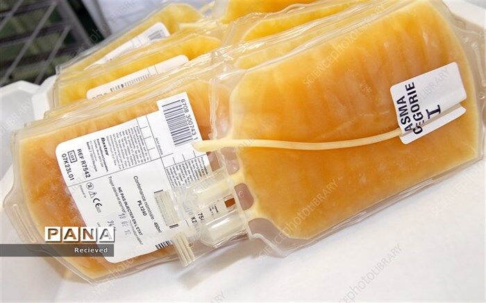 دستگاه پلاسما فریز به دزفول رسید