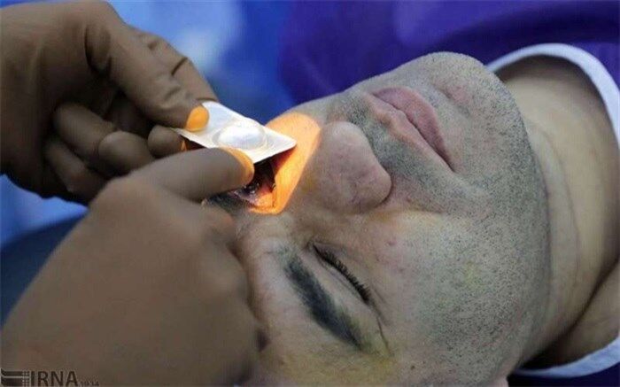 افزایش تنش‌های چشمی در شرایط کرونایی