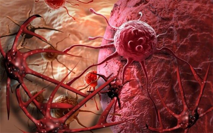 HPV و یک سرطان زنانه