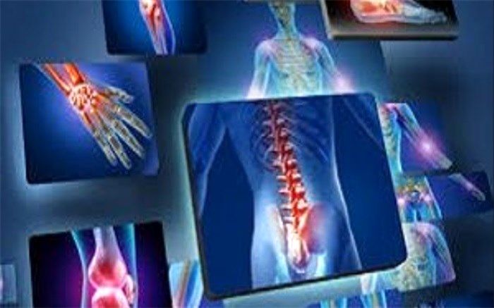 6  خوراکی مفید برای کاهش دردهای مفصلی+اینفوگرافیک