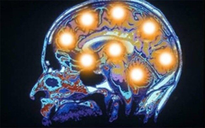 مثبت‌اندیشی را با گوش‌دادن به موسیقی کیهانی "زیر آستانه‌ای" تجربه کنید