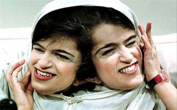 دوقلوهایی که باهم به استقبال مرگ رفتند