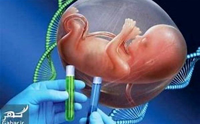 نزدیک به 900خانواده زنجانی دارای معلول ،غربالگری ژنتیک شدند