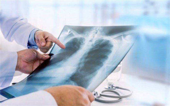 سلامت استخوان و ارتباط آن با سلامت قلب