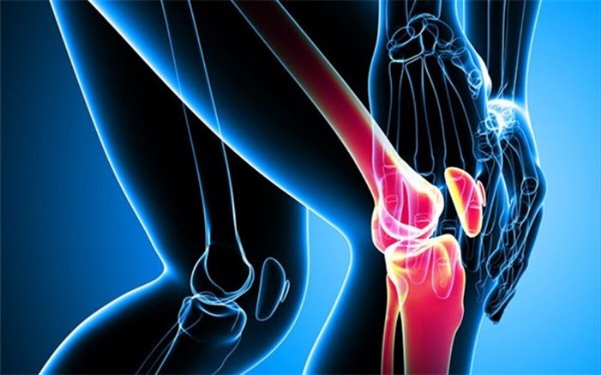 راه‌های جلوگیری از پیشرفت پوکی استخوان