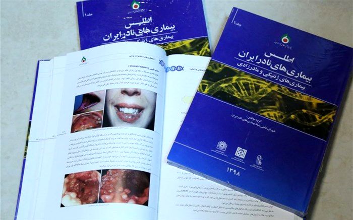 عوارض گمرکی لوازم آرایشی برای درمان بیماری‌های نادر هزینه می‌شود