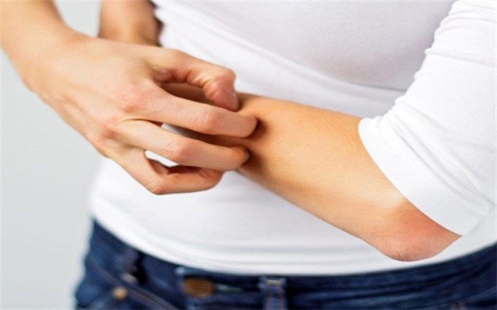 درباره نشانه‌های پوستی کرونا بیشتر بدانید