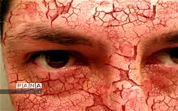 7  نکته جالب درباره پوست
