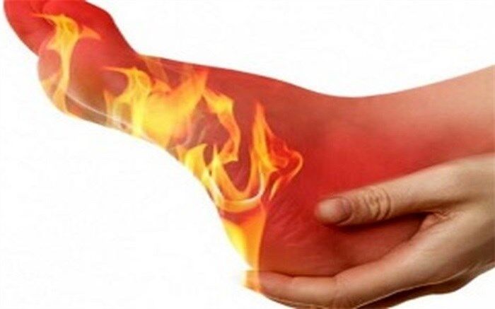 چرا شب‌ها کف پا داغ می‌شود؟