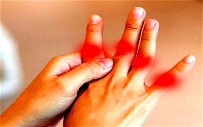 راهکار ساده برای کنترل حملات نقرس