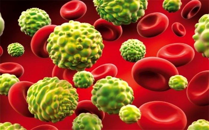 شایع‌ترین علامت ابتلا به سرطان دهان و زبان چیست؟