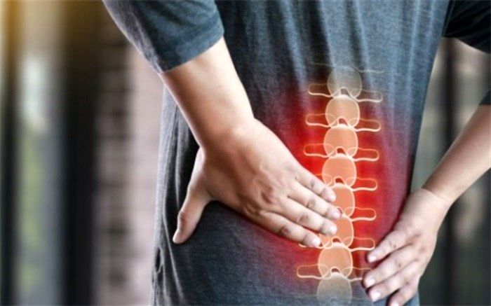 راه‌های پیشگیری از گودی بیش از حد کمر