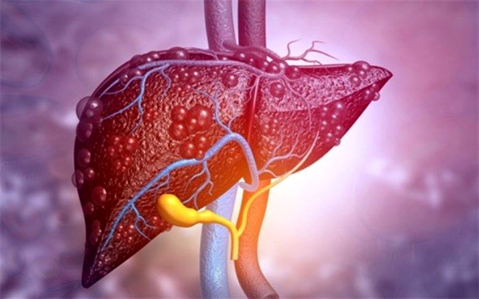 10 راهکار ساده برای کمک به سلامت کبد