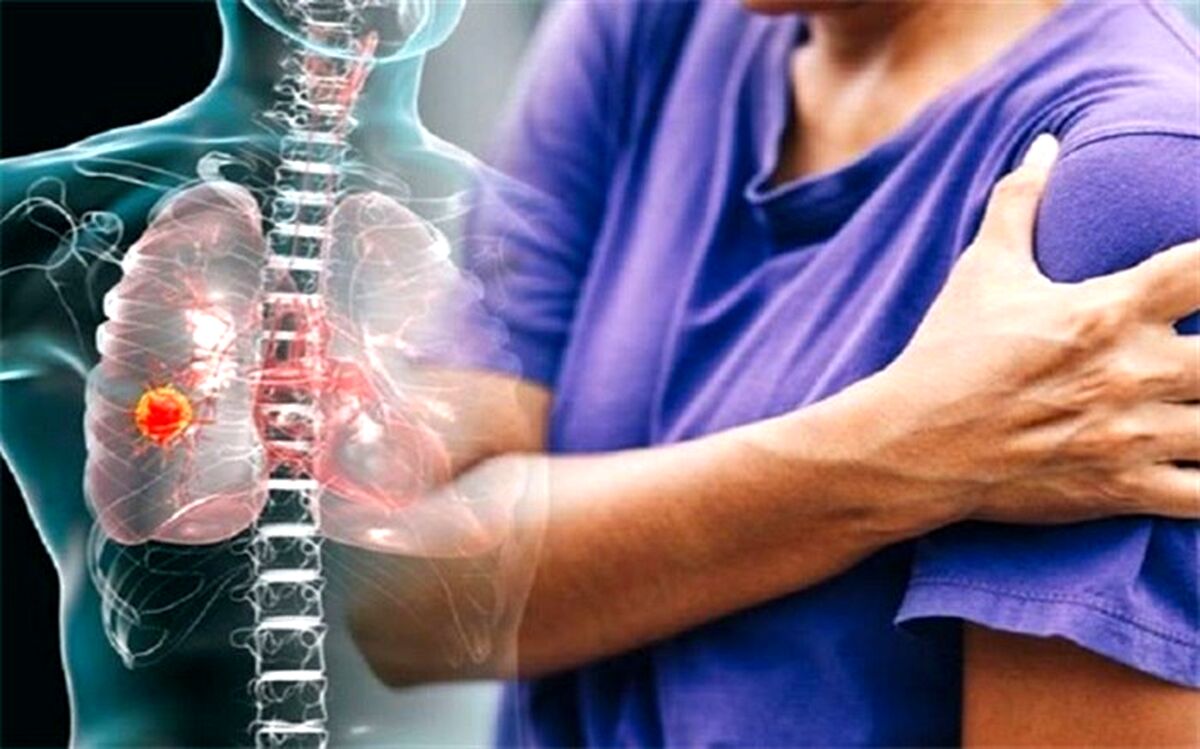 اگر متوجه این درد شدید، ریه‌­هایتان را چک کنید