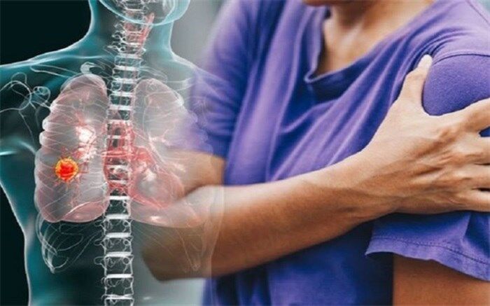 اگر متوجه این درد شدید، ریه‌­هایتان را چک کنید