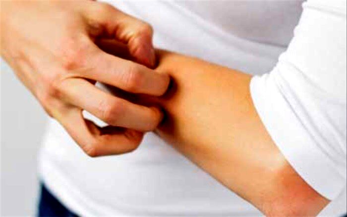 خاراندن این قسمت‌های بدن ممنوع است
