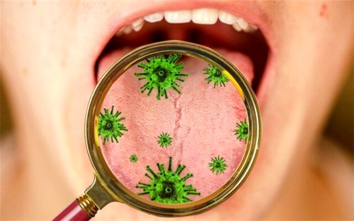 تاثیر ابتلا به کرونا بر دهان