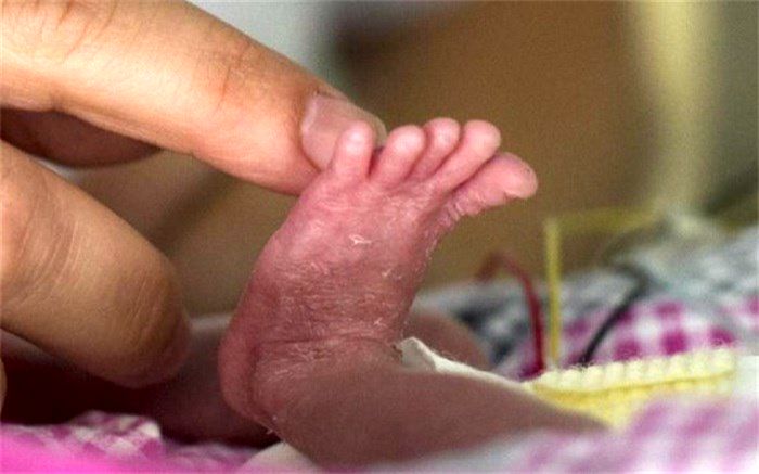 موش،پای کودکی را خورد