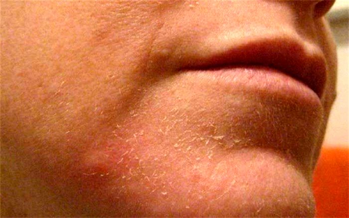 مراقبت از پوست با چند راهکار طلایی