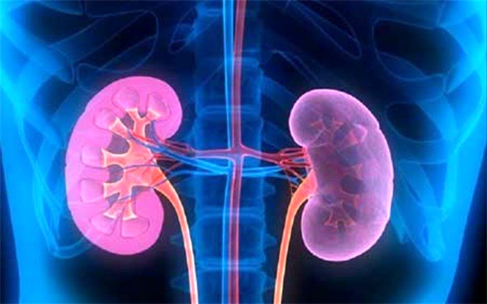 مرگبارترین سرطانی که کلیه‌‌ها را درگیر می‌کند
