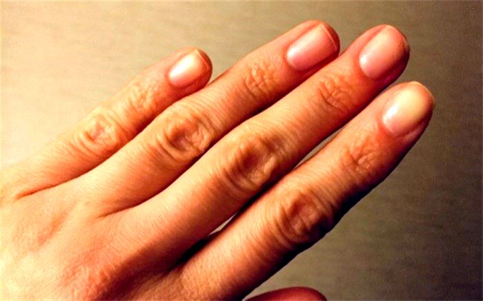 تاثیر استرس در رشد ناخن‌ها