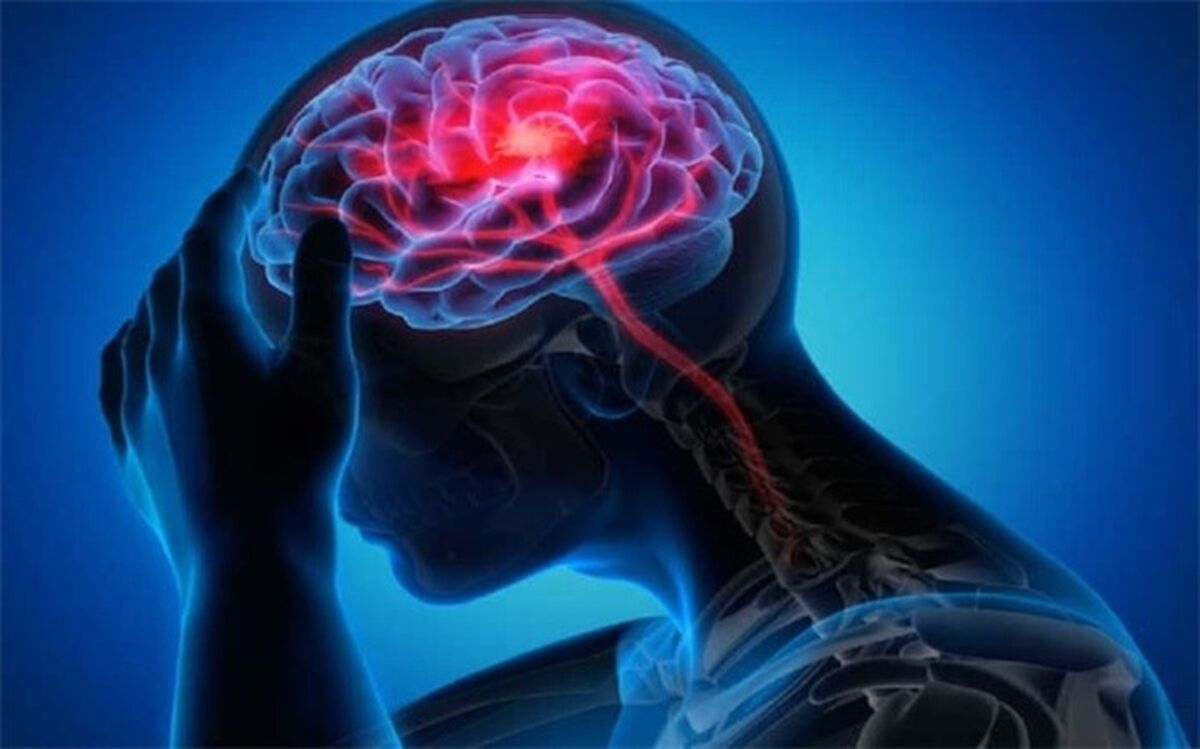 کمبود این ویتامین باعث سکته مغزی می‌شود