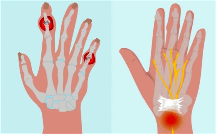 دو بیماری متفاوت با علایم یکسان