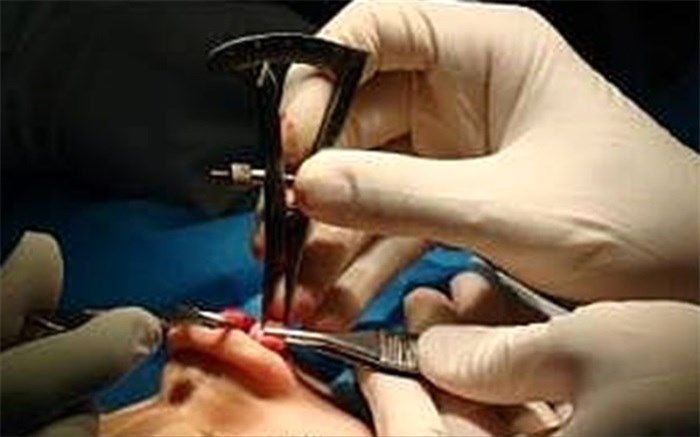 هشدار درباره فروش دستگاه‌های اعمال زیبایی به افراد غیر متخصص