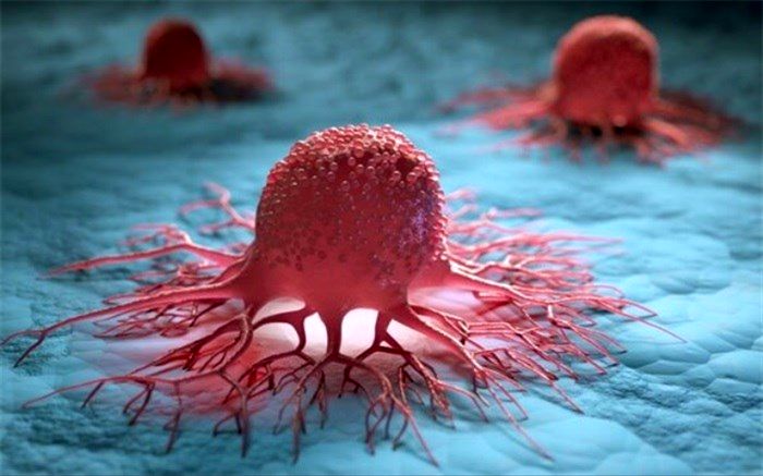 شیمی درمانی خوراکی یا تزریقی، کدامیک موثرتر است؟