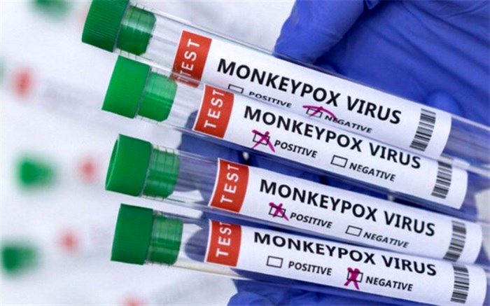 دوره نهفتگی «آبله میمون» چند روز است؟