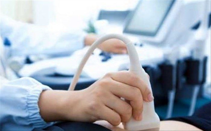 اکوکاردیوگرافی داپلر رنگی در تهران