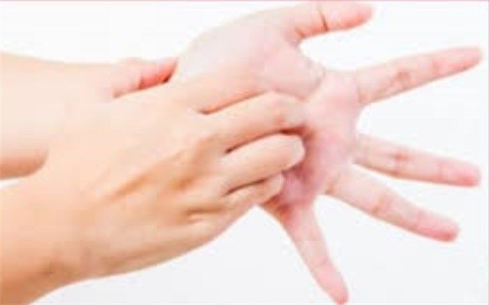 قرمزی کف دست از چه بیماری‌هایی ناشی می‌شود؟