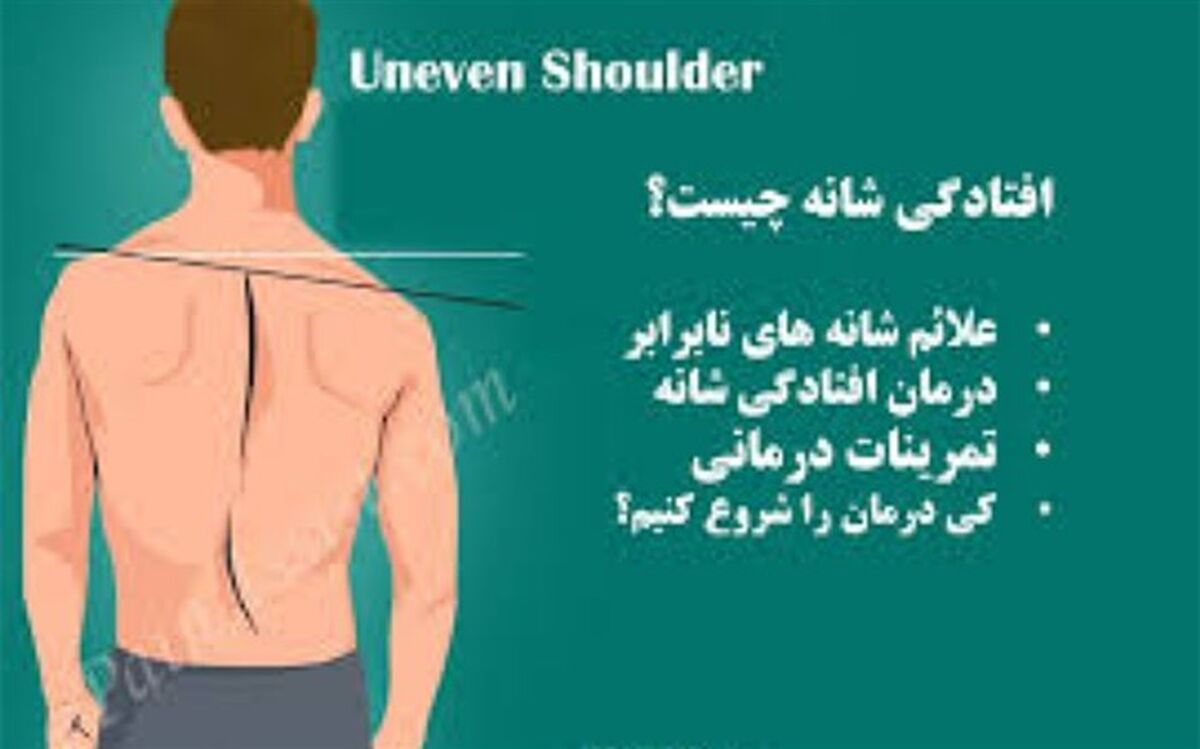 علت بدفرمی بدن  چیست