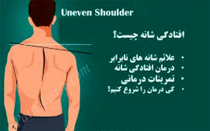 علت بدفرمی بدن  چیست