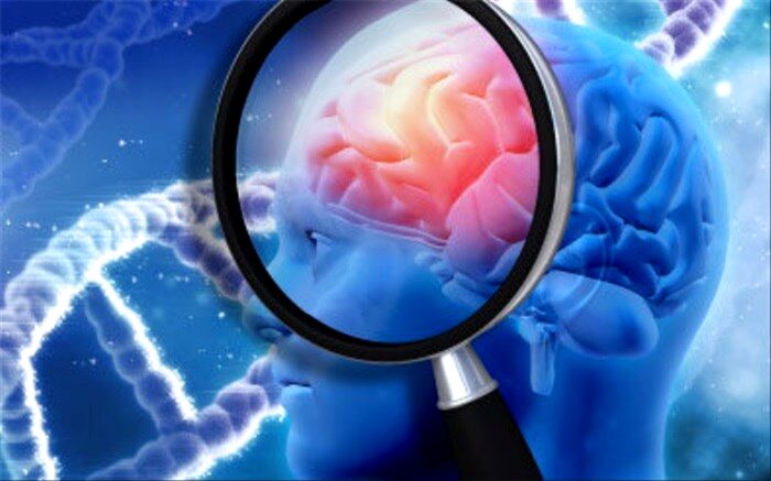 برای مبارزه با فراموشی و آلزایمر چه بخوریم؟