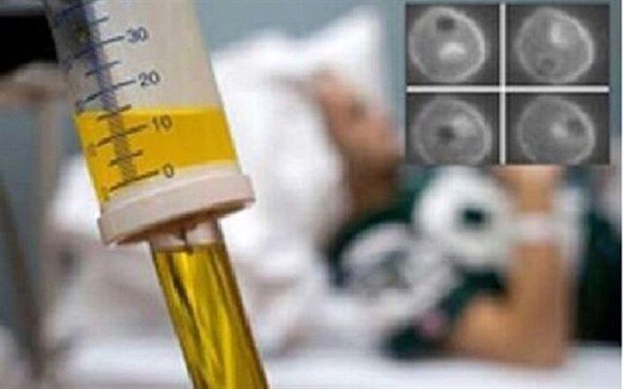 خدمات مرتبط با سرطان در مراکز دولتی مشمول بسته‌های حمایتی است