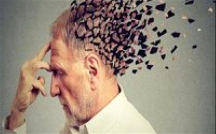 مردان بیشتر آلزایمر می‌گیرند