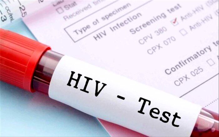 جدیدترین آمار بیماری HIV در کشور اعلام شد