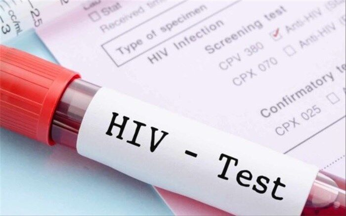 جدیدترین آمار بیماری HIV در کشور اعلام شد
