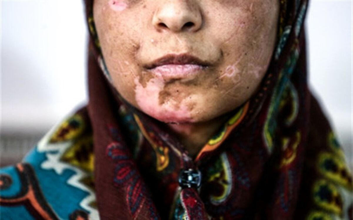 محبی، وکیل دادگستری: خلاء قوانین حمایتی از زنان در برابر خشونت به شدت احساس می‌شود