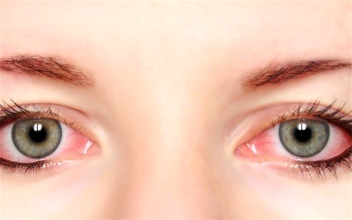 سلامت چشمان خود را با این نکات طلایی تضمین کنید
