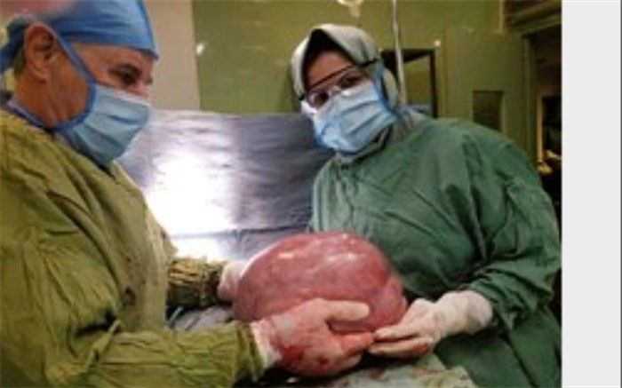 توده 8کیلوگرمی در شکم زن اسلامشهری