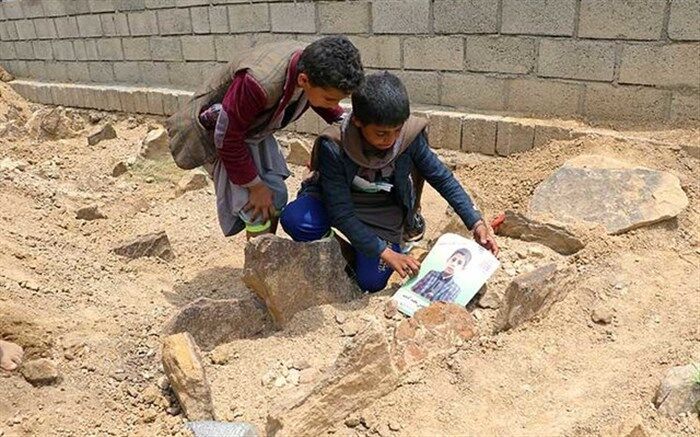 مرگ ۸۵ هزار کودک یمنی بر اثر بیماری و گرسنگی مفرط
