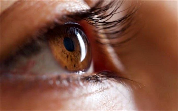 علائم انحراف چشم را بشناسید