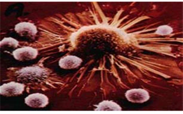 سالانه ۱۱۰هزار‌ نفر در ایران به سرطان مبتلا می‌شوند