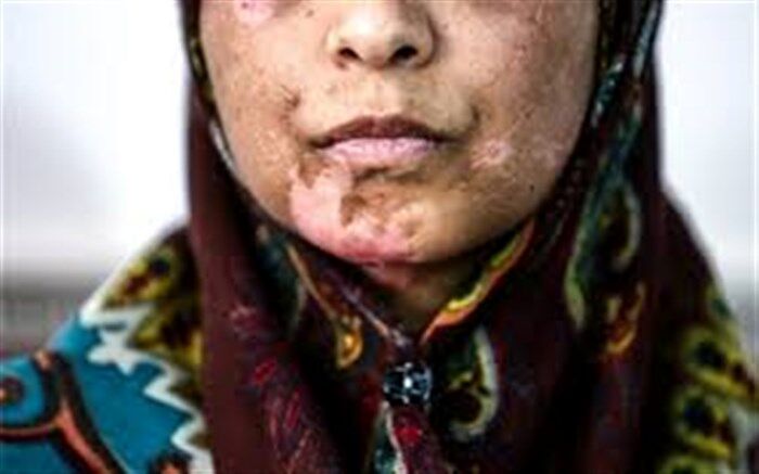 دلیل تعلل قوه قضاییه در ارسال لایحه «تامین امنیت زنان در برابر خشونت» به مجلس چیست